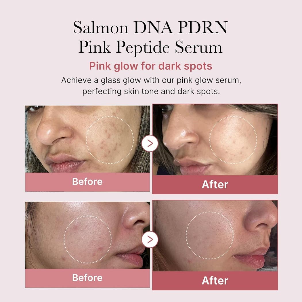 Buy Medicube PDRN Serum in Kuwait Skin Valet