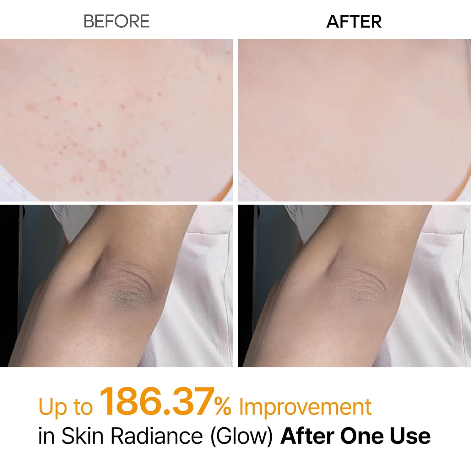 Dr.Melaxin Peel Shot Exfoliating Kojic Acid Turmeric Spray – 200ml