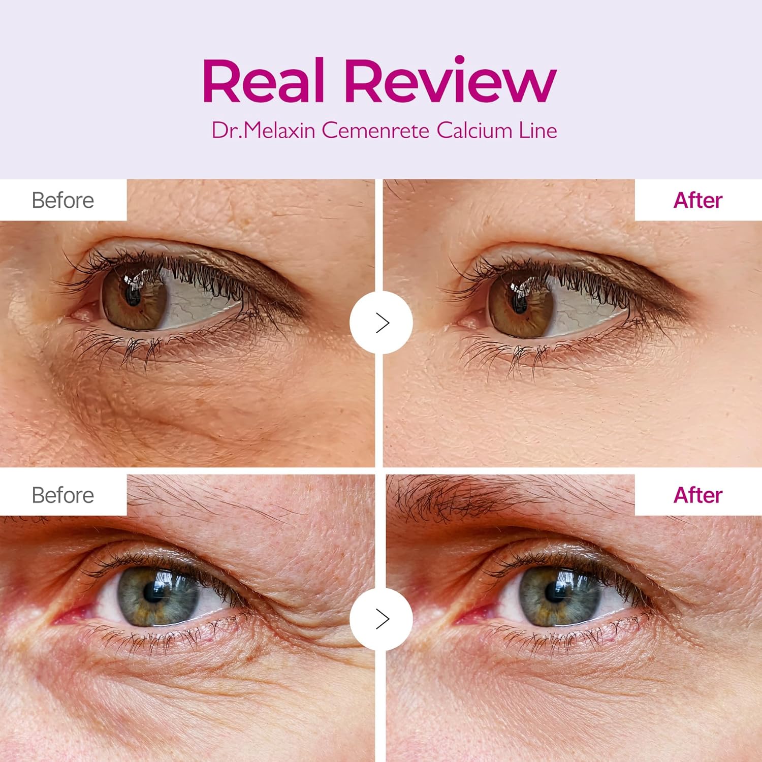 Dr.Melaxin Cemenrete eye patch for crow's feet and nasolabial folds Korean skincare Kuwait