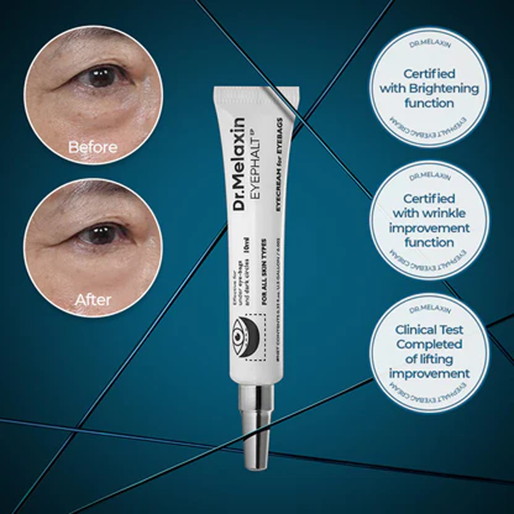 https://cdn.shopify.com/s/files/1/0626/3881/7529/files/Dr.Melaxin_Eyephalt_Eyecream_For_Eyebags_Key_Benefits.png?v=1764680189