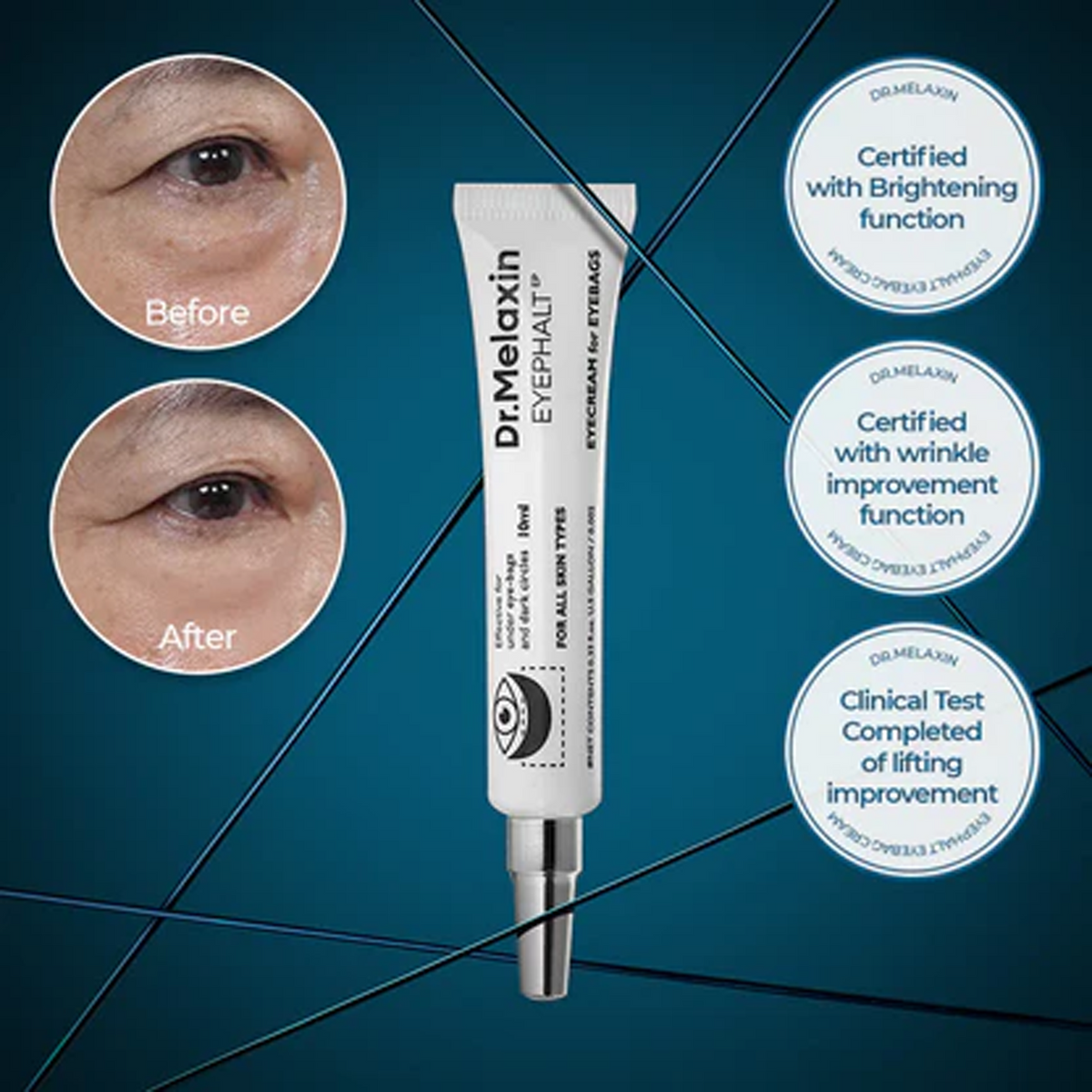 https://cdn.shopify.com/s/files/1/0626/3881/7529/files/Dr.Melaxin_Eyephalt_Eyecream_For_Eyebags_Key_Benefits.png?v=1764680189