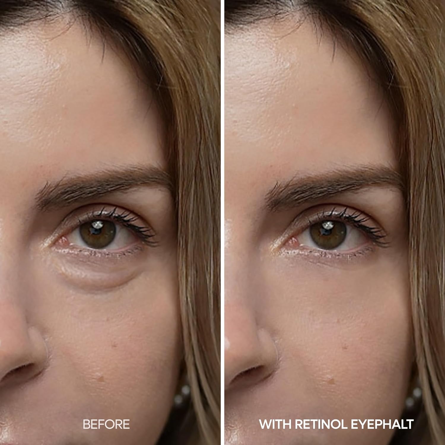 Dr.Melaxin Eyephalt eye bag treatment Korean cosmeceutical skincare Kuwait