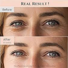 Order Beauty of Joseon Retinal Eye Cream for dark circles and under eye wrinkles  shop in kuwait