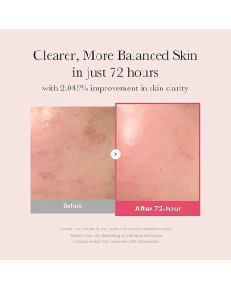 Medicube serum for dark spots and glow Kuwait