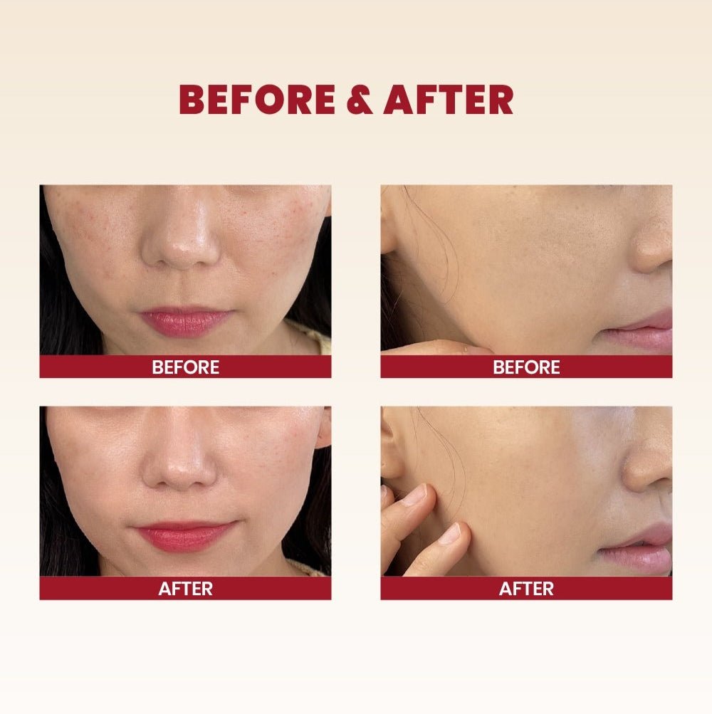 K-SECRET Seoul 1988 Cream: Snail Mucin 93% + Rice 100ml