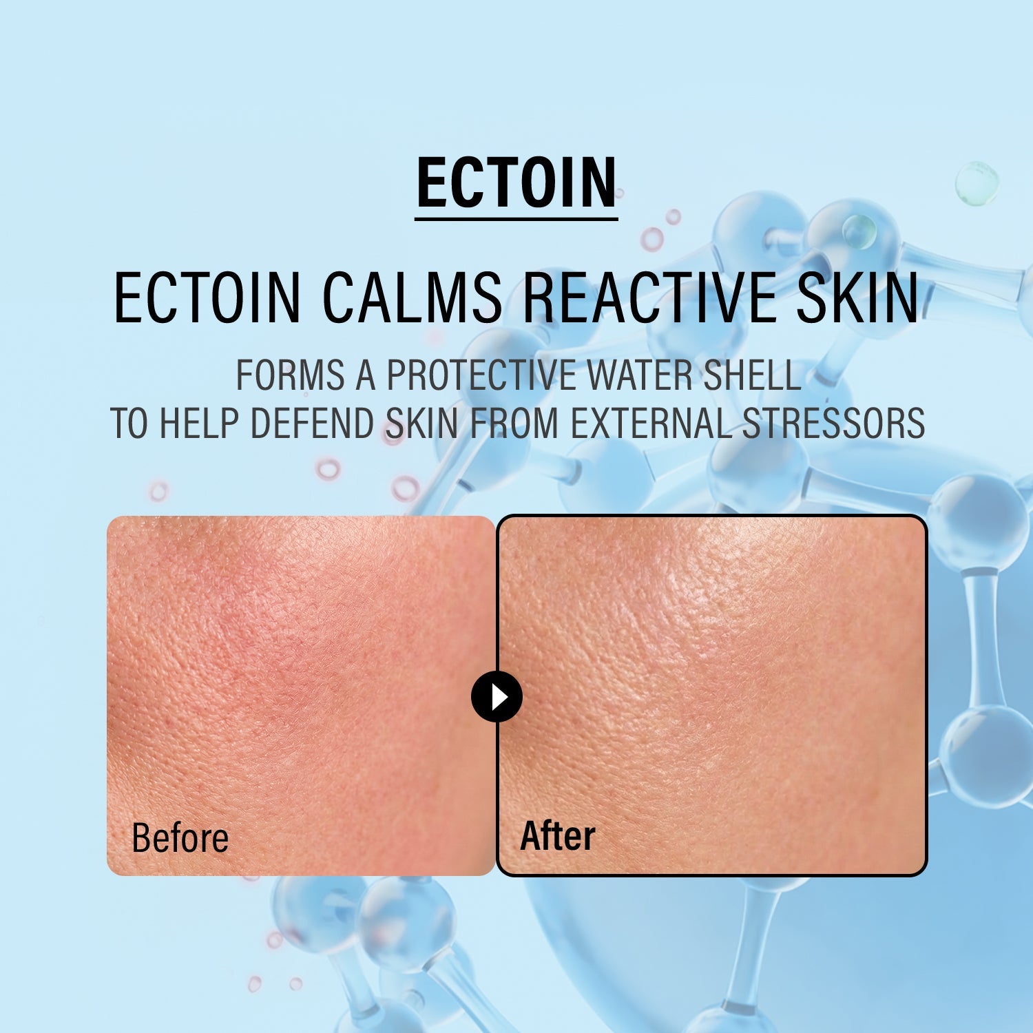 epii - Double Up Cream - Ectoin & Panthenol - 50mL