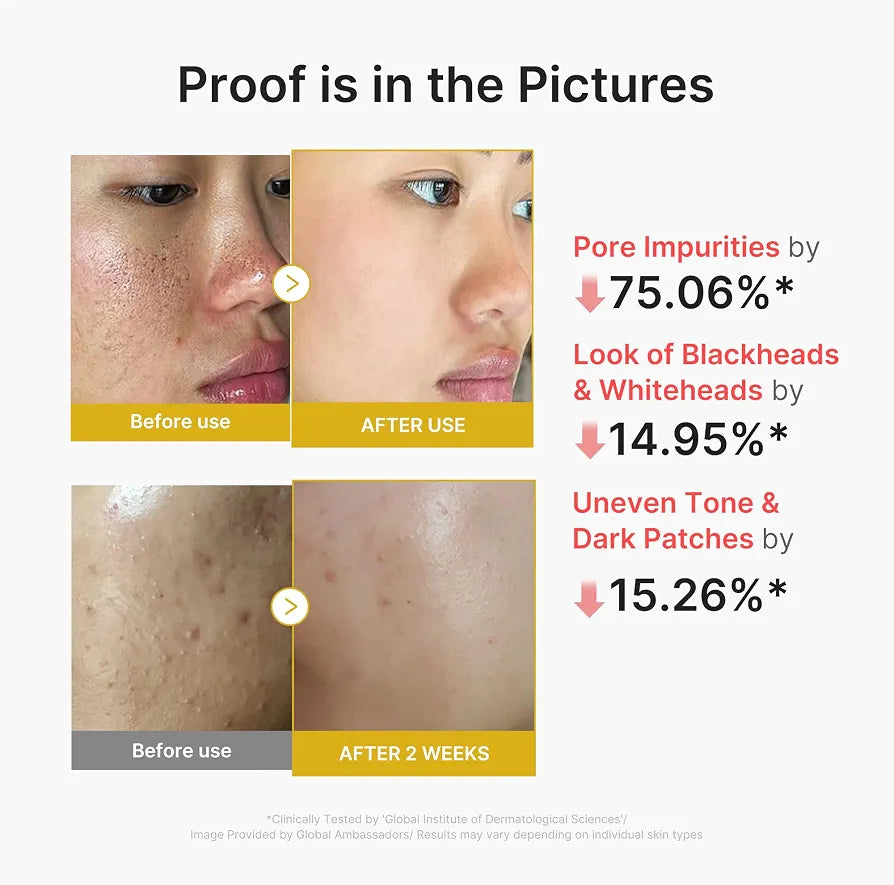 Medicube - Kojic Acid Turmeric Peel Shot